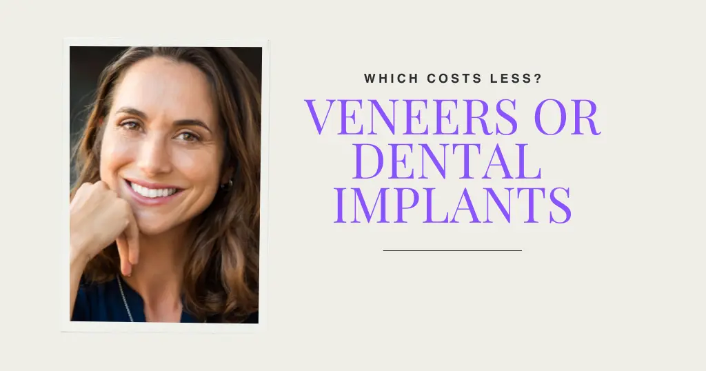 Veneers Comparison Blog